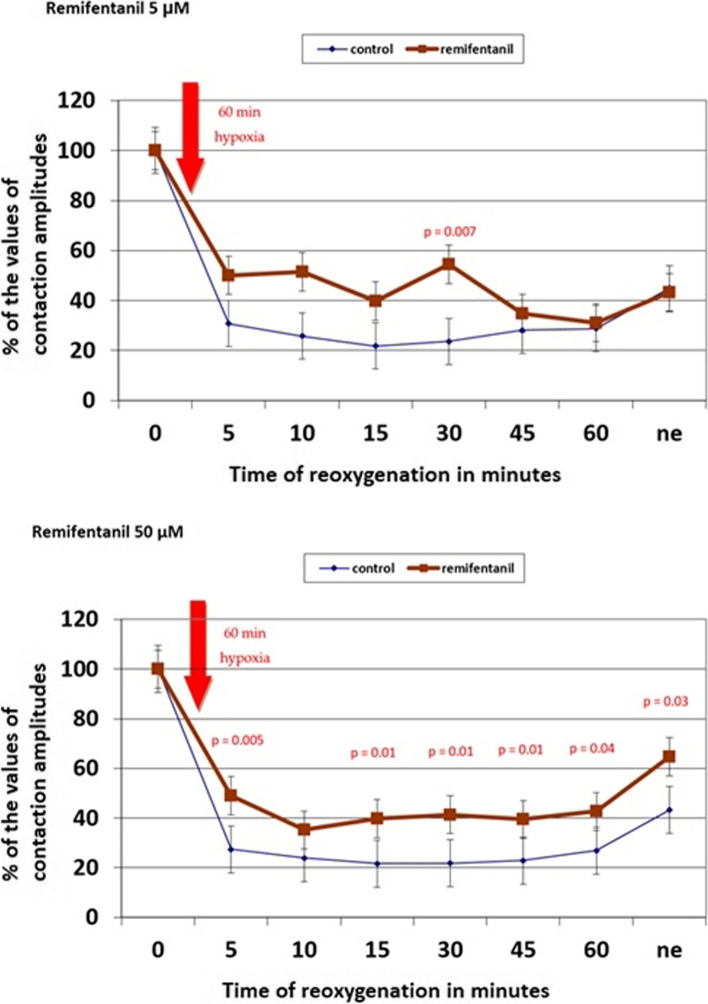 Remifentanil but not sufentanil induces cardioprotection in human ischemic heart muscle in vitro.