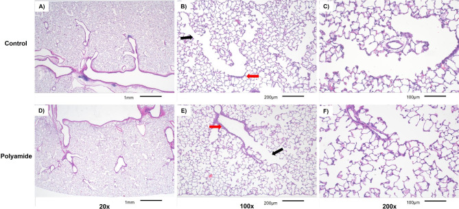 Single inhalation exposure to polyamide micro and nanoplastic particles impairs vascular dilation without generating pulmonary inflammation in virgin female Sprague Dawley rats.