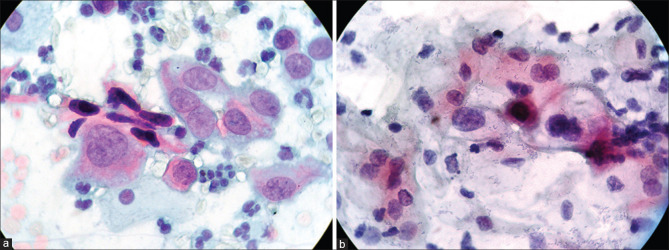 Quality and Performance of Papanicolaou Test using the Clinical and Laboratory Standards Institute (CLSI) EP12-A2 Guidelines: A Single-Center Study in Peru.