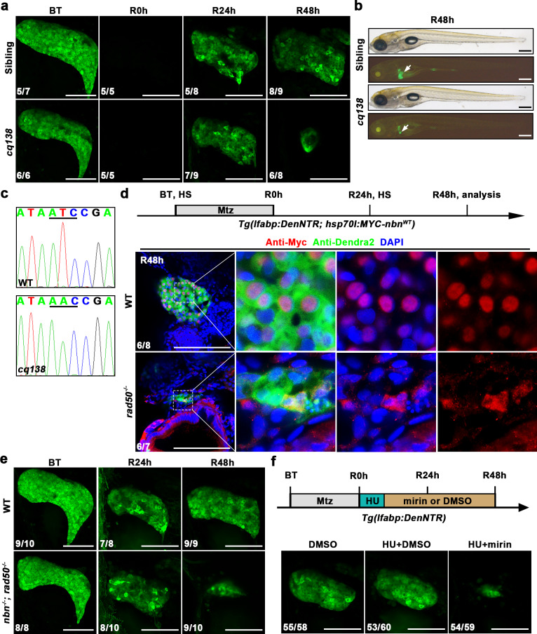 The MRN complex maintains the biliary-derived hepatocytes in liver regeneration through ATR-Chk1 pathway.