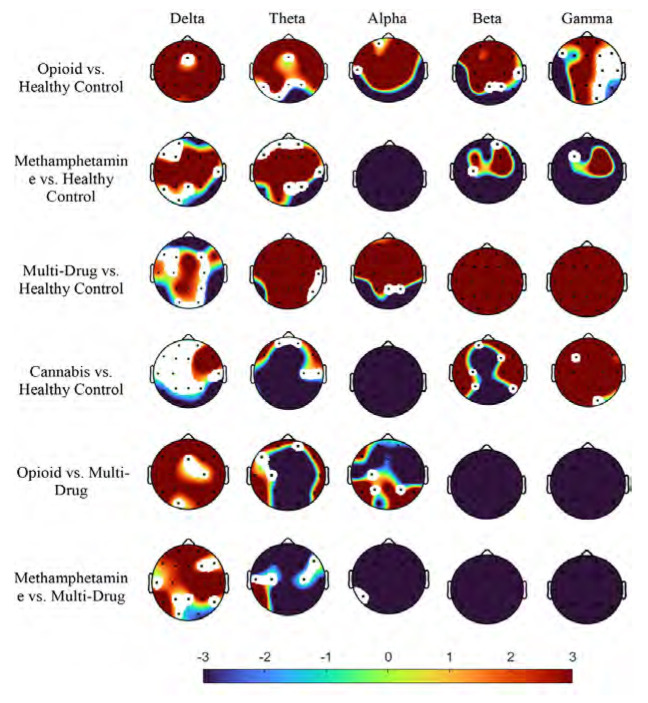 Evaluation of Drug Abuse on Brain Function using Power Spectrum Analysis of Electroencephalogram Signals in Methamphetamine, Opioid, Cannabis, and Multi-Drug Abuser Groups.