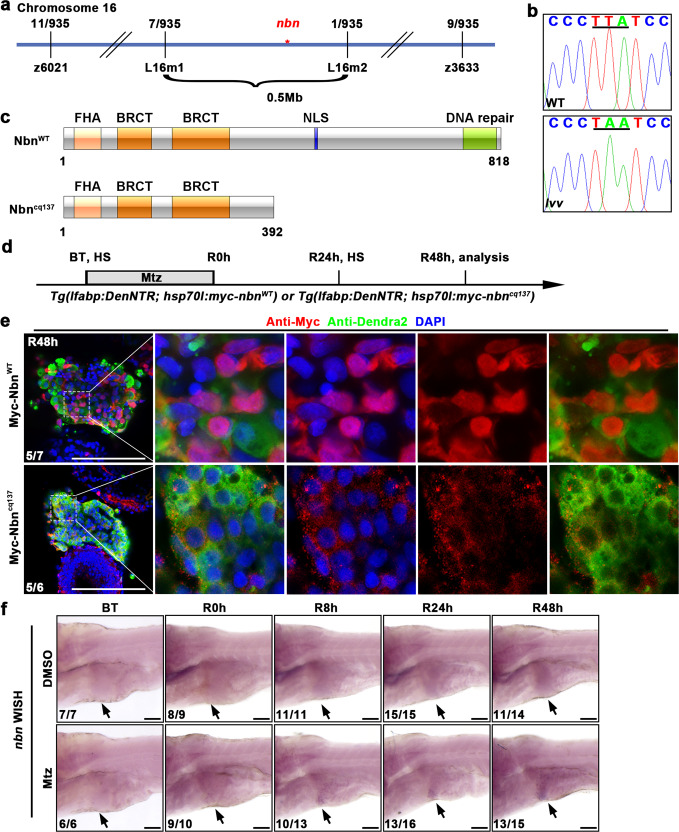 The MRN complex maintains the biliary-derived hepatocytes in liver regeneration through ATR-Chk1 pathway.