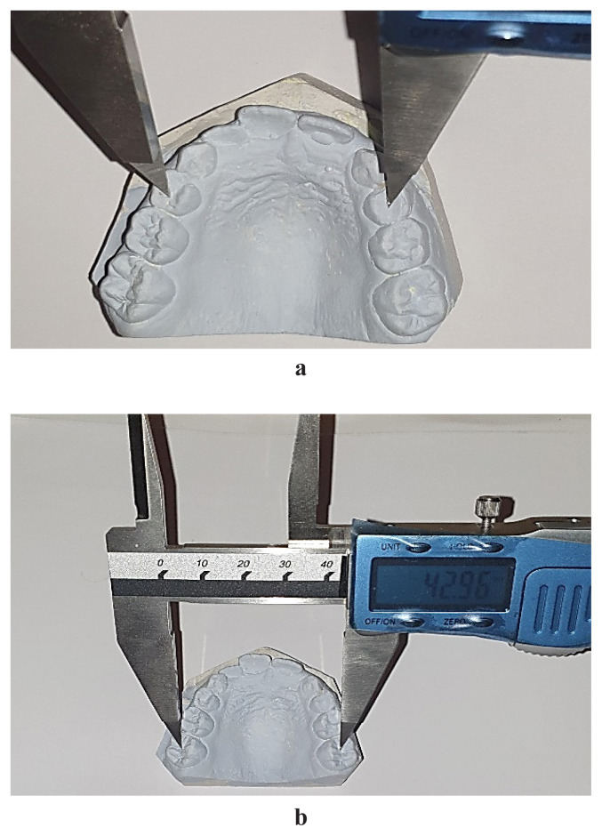 Assessing the morphological characteristics of teeth and dental arches as potential predictors of dental crowding.