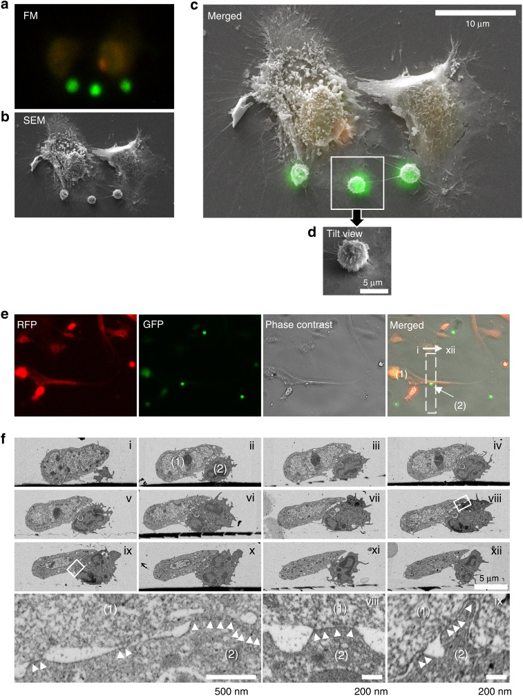 Mobilization of monocytic myeloid-derived suppressor cells is regulated by PTH1R activation in bone marrow stromal cells.