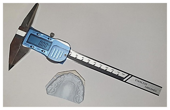 Assessing the morphological characteristics of teeth and dental arches as potential predictors of dental crowding.