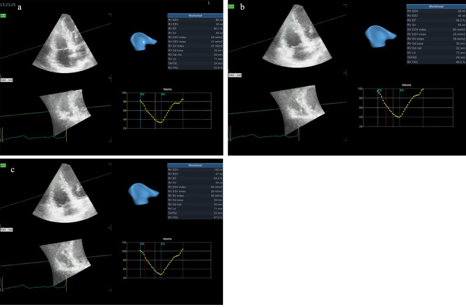 Detection of right ventricular dysfunction by three - dimensional echocardiography and two - dimensional speckle tracking in breast cancer patients receiving anthracycline- based chemotherapy.