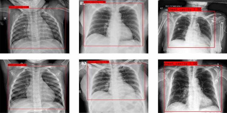 A new classification method for diagnosing COVID-19 pneumonia based on joint CNN features of chest X-ray images and parallel pyramid MLP-mixer module.