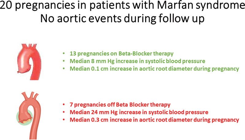 Beta-Blocker Use during Pregnancy Correlates with Less Aortic Root Dilatation in Patients with Marfan's Syndrome.