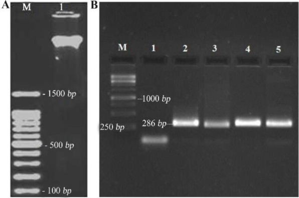 Development of a High Sensitive Multiplex Lateral Flow Immunoassay (LFIA) System for Rapid Detection of Methicillin-Resistant Staphylococcus Aureus (MRSA).