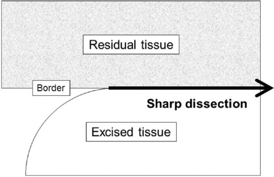 Reconsideration of Sharp Dissection in Gynecological Surgery.