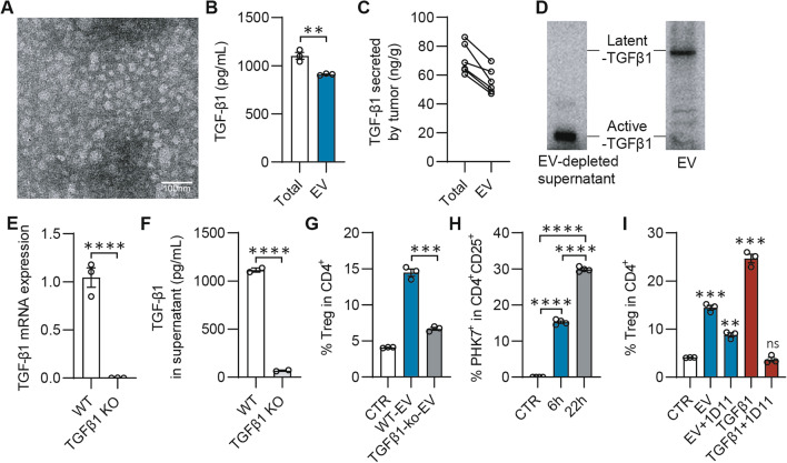 PKC-ζ mediated reduction of the extracellular vesicles-associated TGF-β1 overcomes radiotherapy resistance in breast cancer.