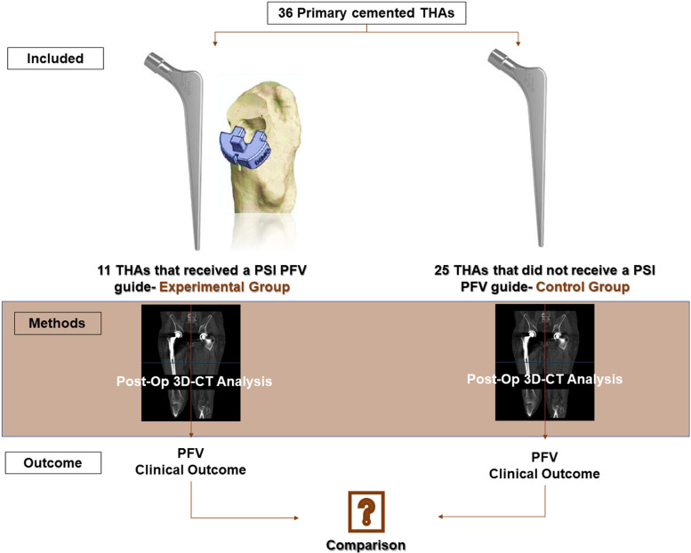 Guiding prosthetic femoral version using 3D-printed patient-specific instrumentation (PSI): a pilot study.