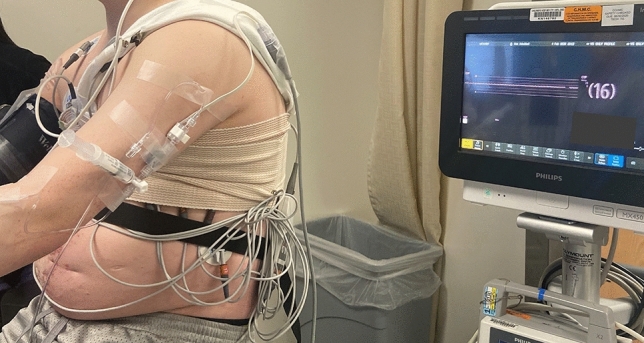 Isosorbide DiNitrate Effect on Hemodynamic Profile, Liver Stiffness, and Exercise Tolerance in Fontan Circulation (The NEET Clinical Trial).