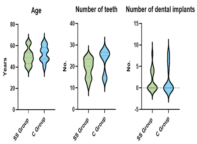 Clinical Evaluation of Periodontal Status and IL-6 Gingival Fluid Level in Patients with Sjogren's Syndrome.