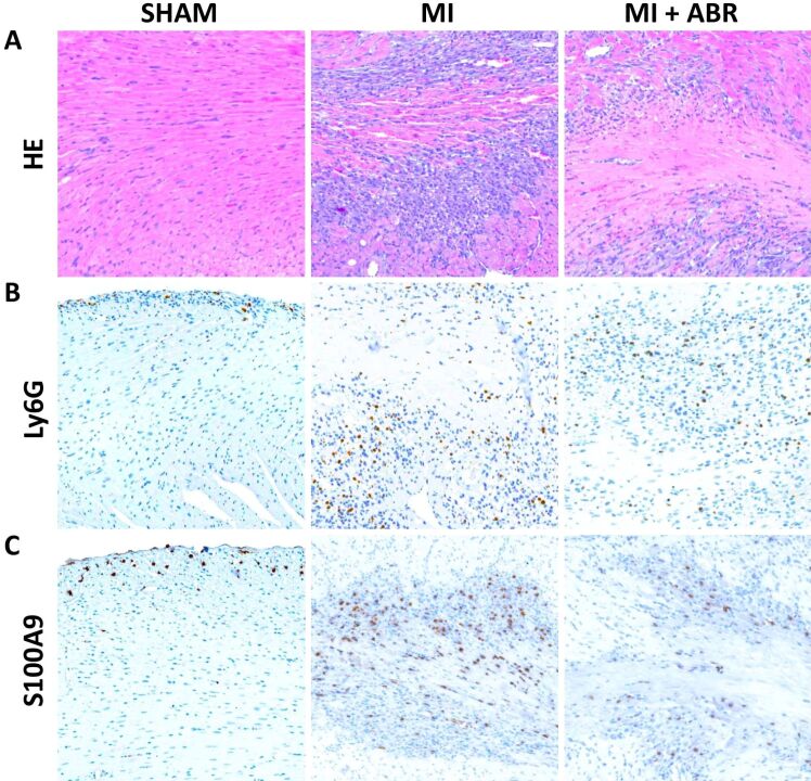 S100A8∕A9 is a valuable biomarker and treatment target to detect and modulate neutrophil involvement in myocardial infarction.