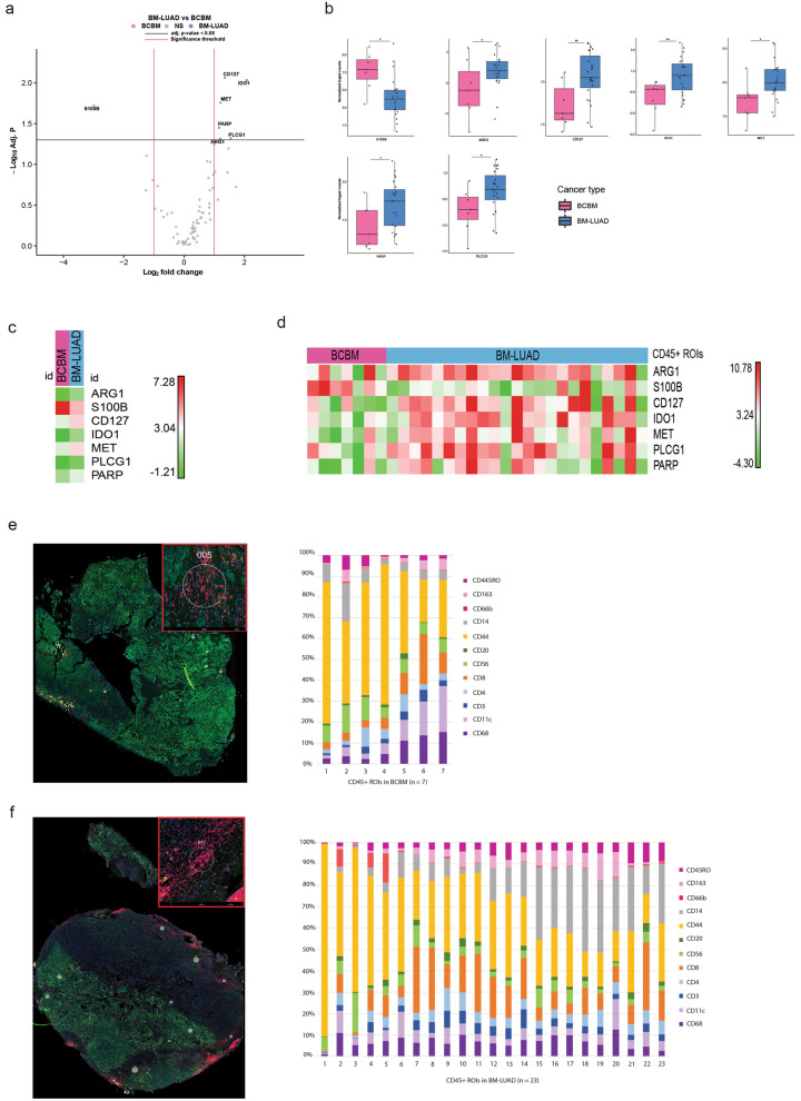 Tumor lineage-specific immune response in brain metastatic disease: opportunities for targeted immunotherapy regimen?