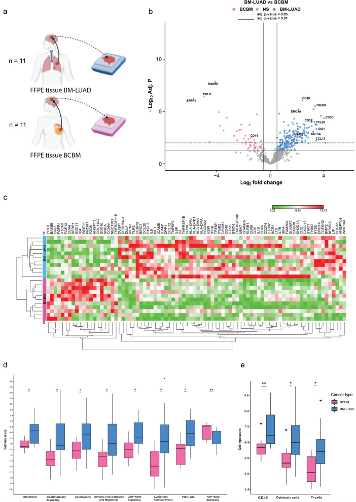 Tumor lineage-specific immune response in brain metastatic disease: opportunities for targeted immunotherapy regimen?