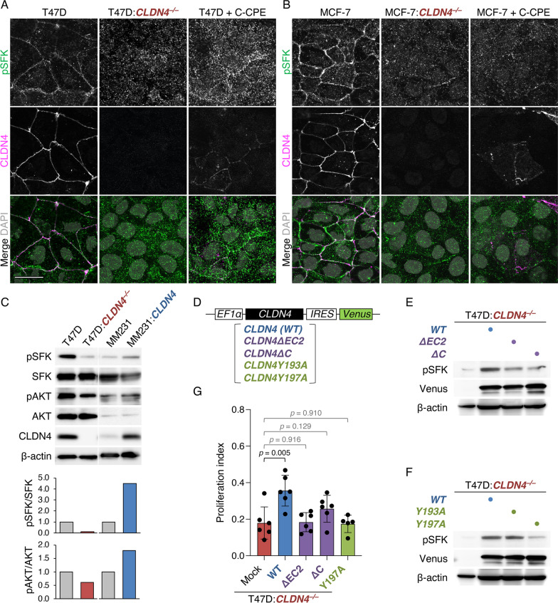 Claudin-4-adhesion signaling drives breast cancer metabolism and progression via liver X receptor β.