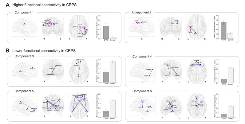 Aberrant Resting-state Functional Connectivity in Complex Regional Pain Syndrome: A Network-based Statistics Analysis.