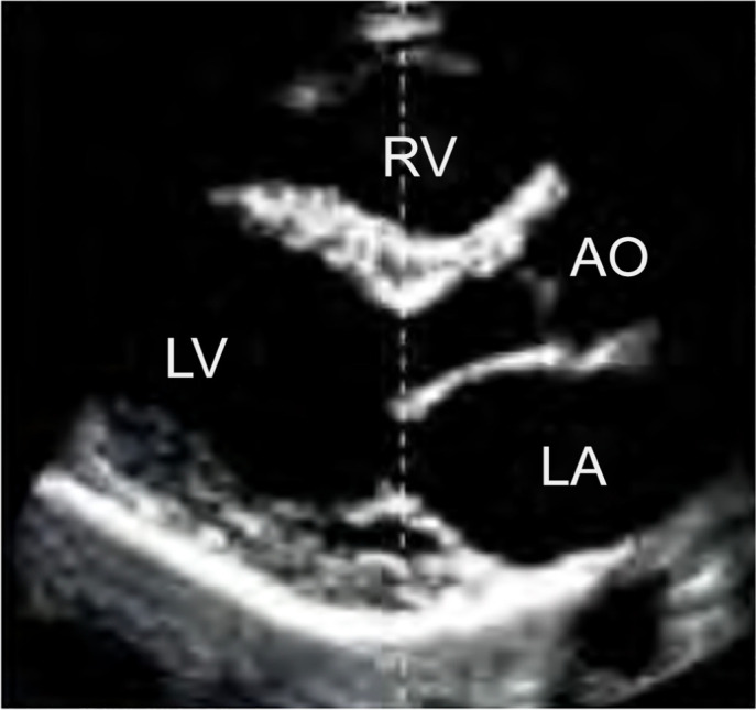 The use of bedside echocardiography in the care of critically ill patients - a joint consensus document of the Associação de Medicina Intensiva Brasileira, Associação Brasileira de Medicina de Emergência and Sociedade Brasileira de Medicina Hospitalar. Part 2 - Technical aspects.