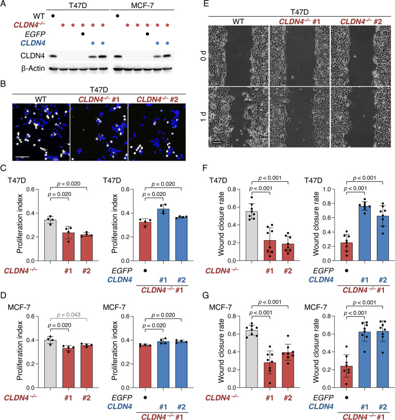 Claudin-4-adhesion signaling drives breast cancer metabolism and progression via liver X receptor β.