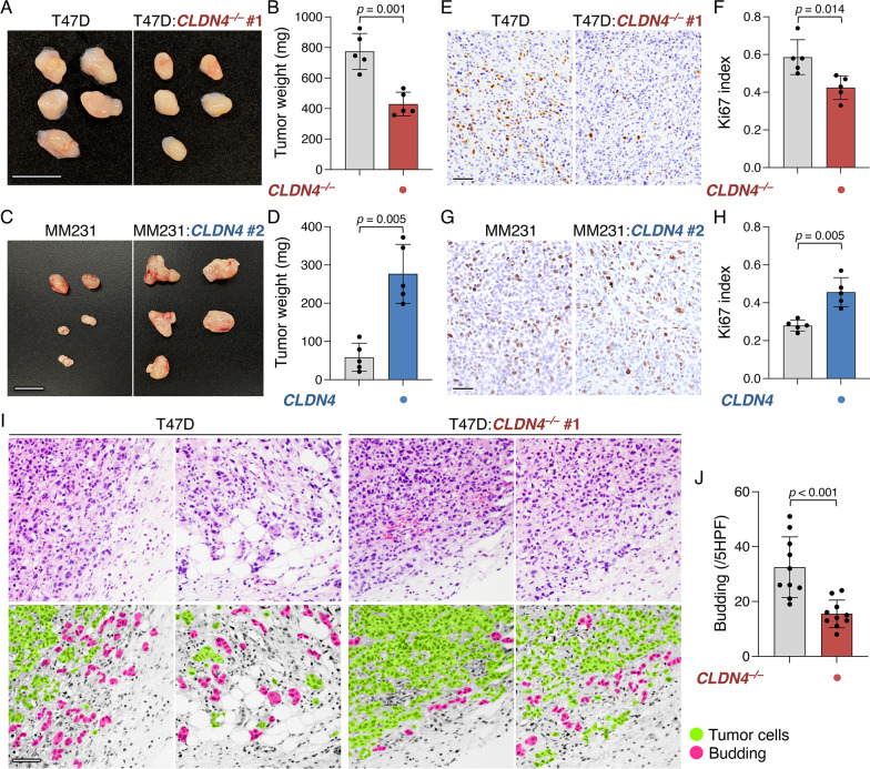 Claudin-4-adhesion signaling drives breast cancer metabolism and progression via liver X receptor β.