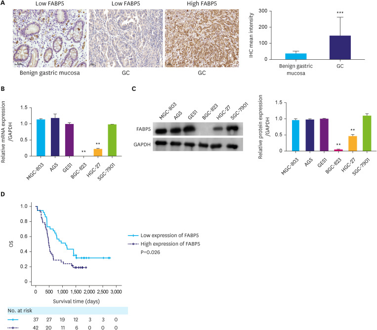 Fatty Acid Binding Protein 5 (FABP5) Promotes Aggressiveness of Gastric Cancer Through Modulation of Tumor Immunity.