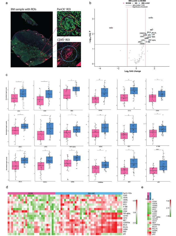 Tumor lineage-specific immune response in brain metastatic disease: opportunities for targeted immunotherapy regimen?