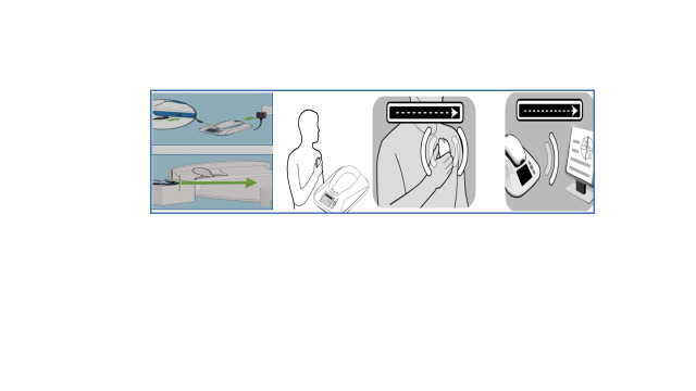 Remote Monitoring in Cardiac Resynchronization Therapy-First Experience in Romania with a CRT Virtual Ward.