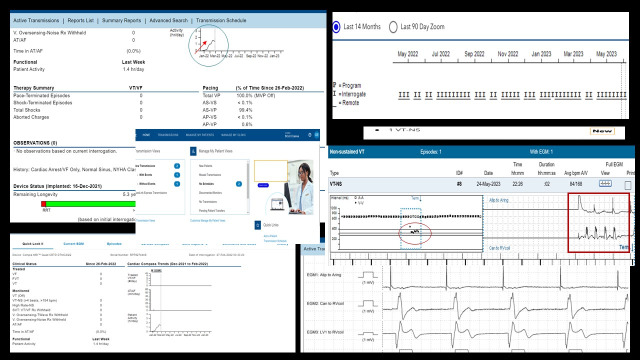 Remote Monitoring in Cardiac Resynchronization Therapy-First Experience in Romania with a CRT Virtual Ward.