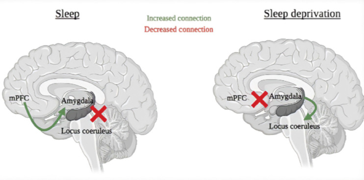 The consequences of sleep deprivation on cognitive performance.