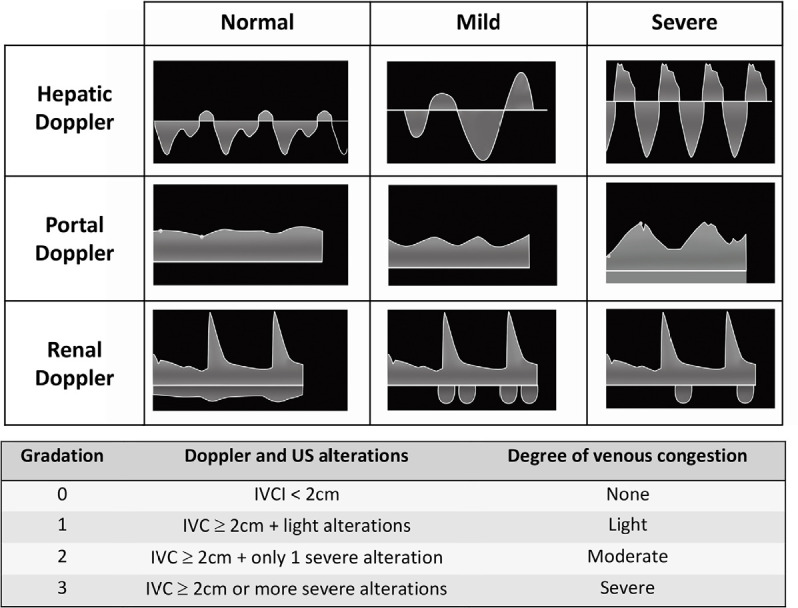 Beyond fluid responsiveness: the concept of fluid tolerance and its potential implication in hemodynamic management.