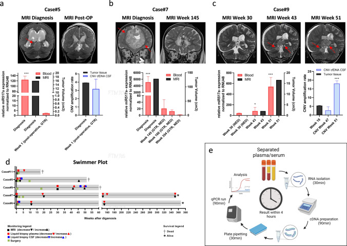 Clinical applicability of miR517a detection in liquid biopsies of ETMR patients