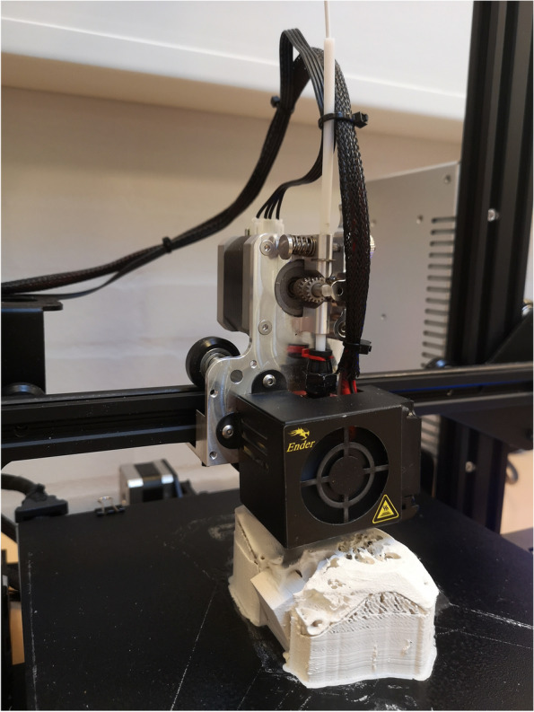 3D-printing a cost-effective model for mastoidectomy training.