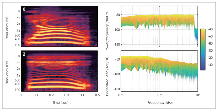 Factors Influencing the Korean Version of the Digit-in-Noise Test.