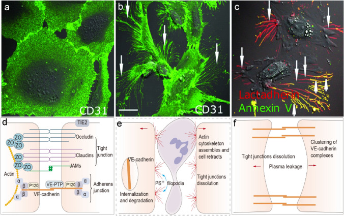 Damage to endothelial barriers and its contribution to long COVID