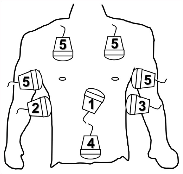 Focused Assessment with Sonography for Trauma (FAST).