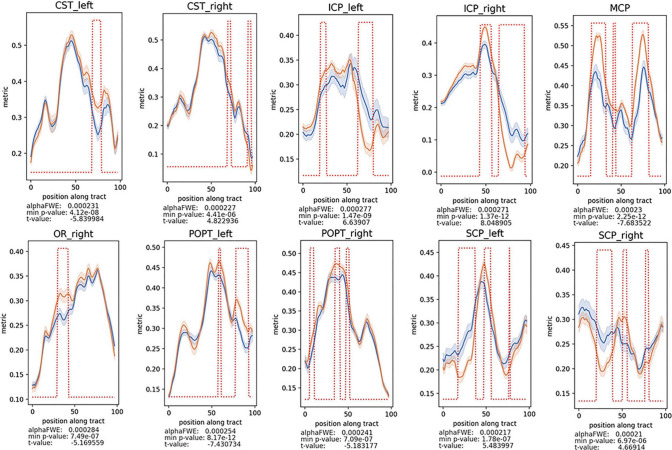 Automated three-dimensional major white matter bundle segmentation using diffusion magnetic resonance imaging