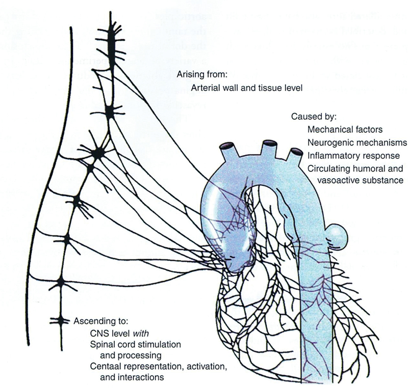 Nonsize Criteria for Surgical Intervention on the Ascending Thoracic Aorta.