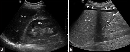 Focused Assessment with Sonography for Trauma (FAST).