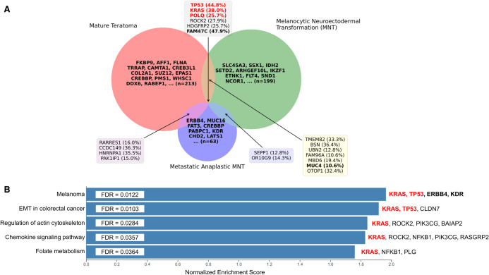 Genomic profiling of a metastatic anaplastic melanocytic neuroectodermal tumor arising from a mature thymic teratoma as part of a mediastinal germ cell tumor.