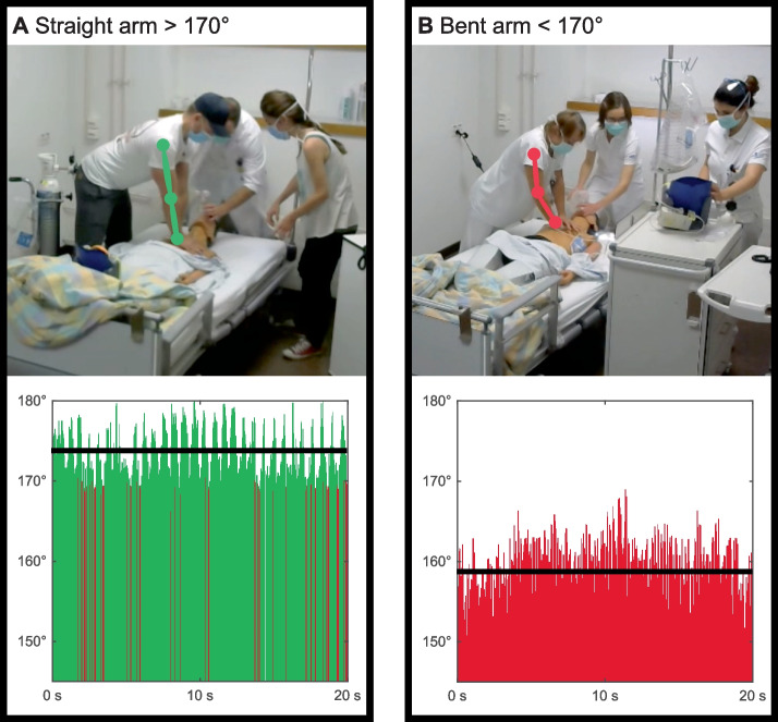 Data-driven resuscitation training using pose estimation.