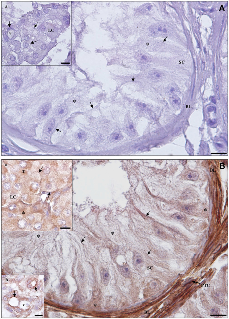 Spatial Distribution of SARS-CoV-2 Receptors and Proteases in Testicular Cells.