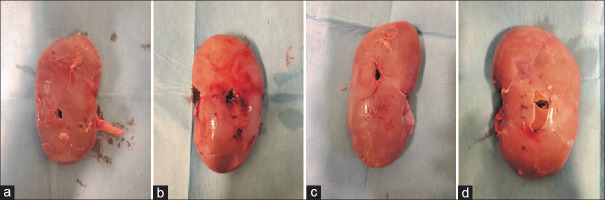 The effect of percutaneous tract dilation technique on renal parenchymal trauma: An experimental <i>in vivo</i> study on a porcine model.