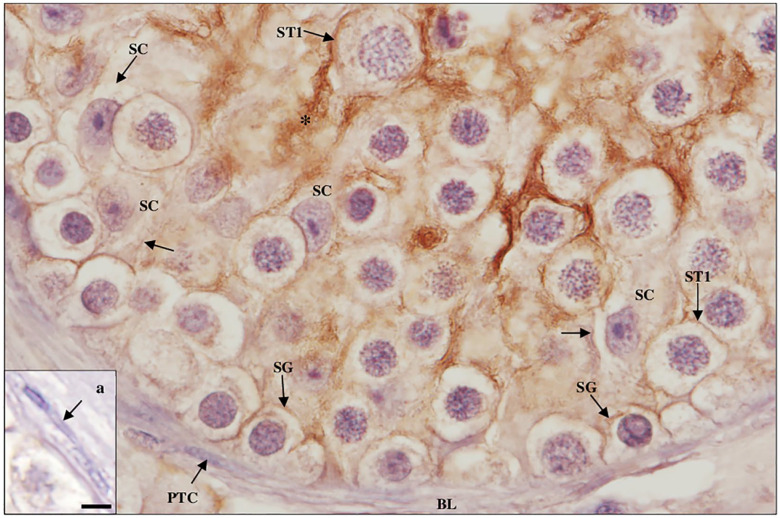 Spatial Distribution of SARS-CoV-2 Receptors and Proteases in Testicular Cells.