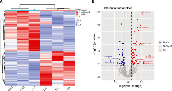 Circulating endothelial microvesicles and their carried miR-125a-5p: potential biomarkers for ischaemic stroke.