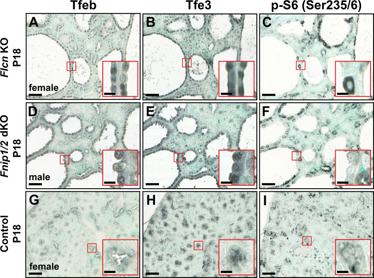 Functional TFEB activation characterizes multiple models of renal cystic disease and loss of polycystin-1.