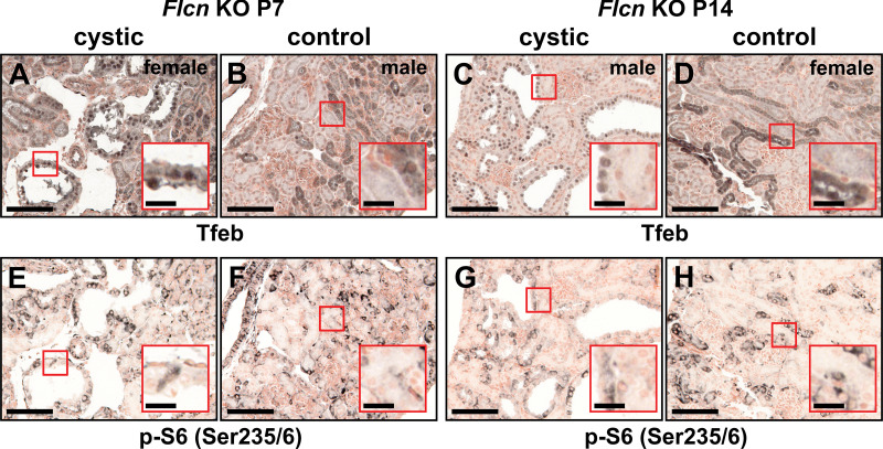 Functional TFEB activation characterizes multiple models of renal cystic disease and loss of polycystin-1.