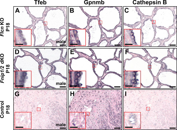 Functional TFEB activation characterizes multiple models of renal cystic disease and loss of polycystin-1.