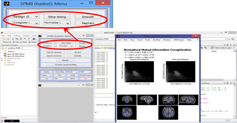 Independent Component Analysis with Functional Neuroscience Data Analysis.